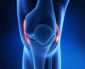 Артроскопическая реконструкция или замена связок колена