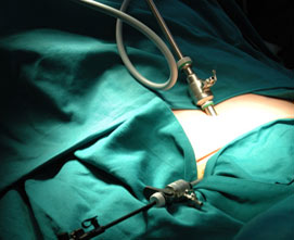 Лазерная артроскопическая хирургия в лечении суставов